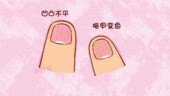 灰指甲复发是什么原因导致的