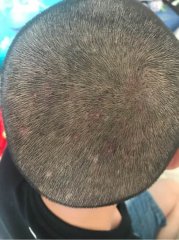 ë���׵���������Щ