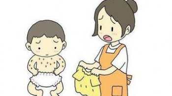 鱼鳞病发作时是什么样的