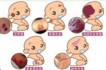 ëϸѪ�������ٴ�����